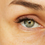 what causes puffy eyes