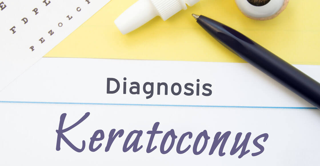 keratoconus treatment